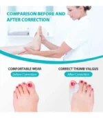 Bunion Silicone Splint Big Toe Separator